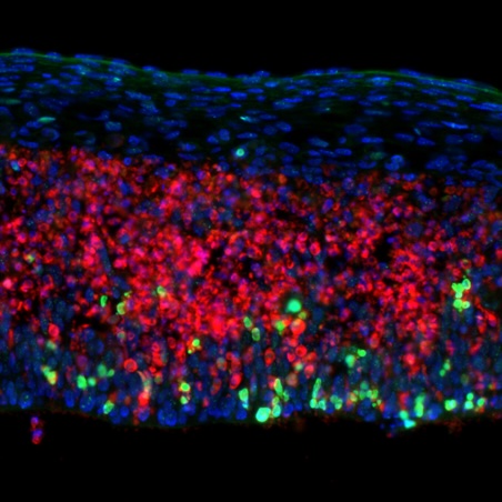 In developing mice, CUX2 neurons lacking a DNA repair enzyme succumb to DNA damage. Cells are shown in blue; DNA damage in green; and dying cells in red. The same neurons die in MS, as  inflammation from the disease causes overwhelming DNA damage.